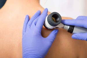 طب الأمراض الجلدية