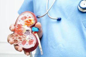 طب المسالك البولية